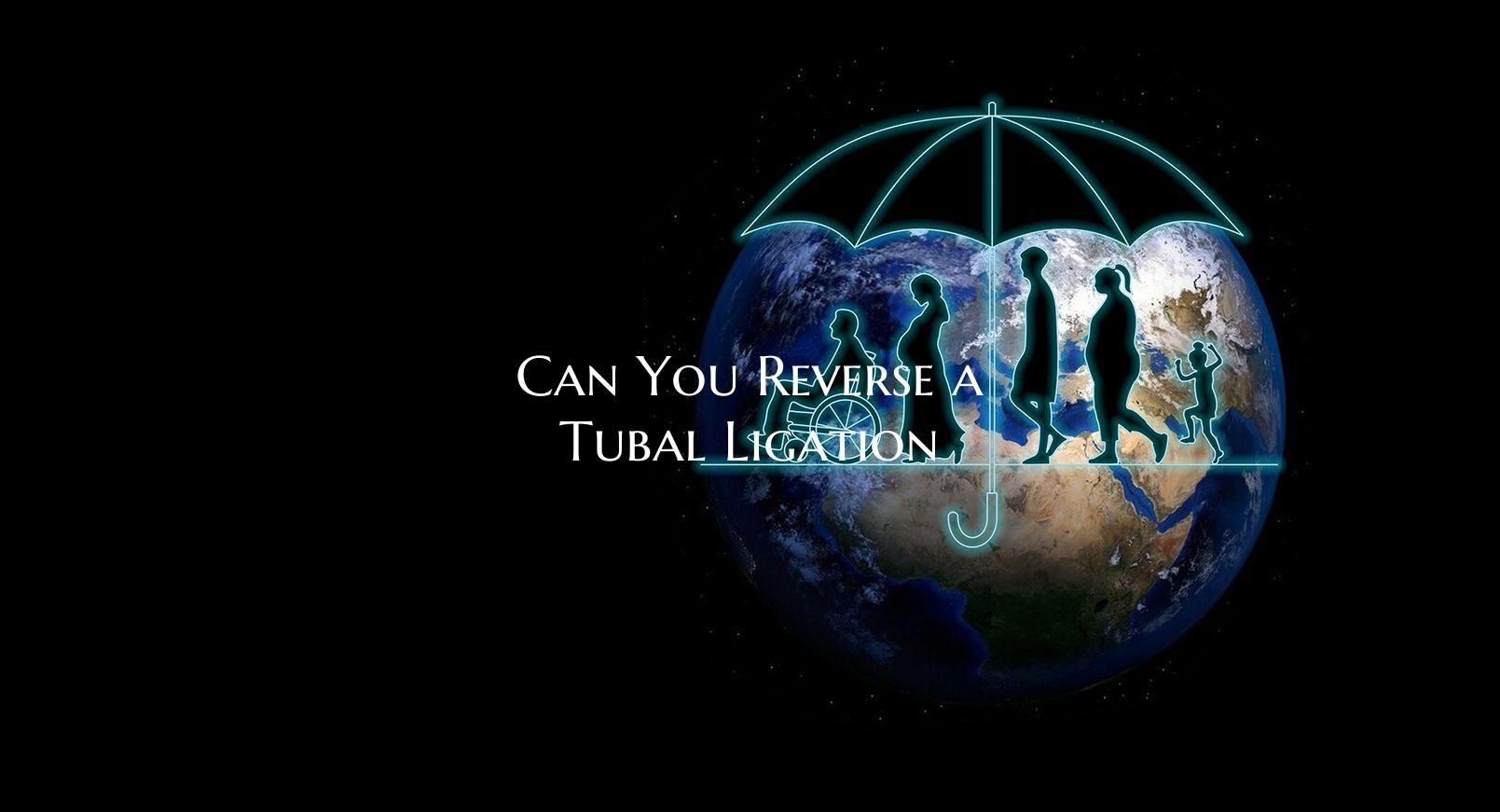 Can You Reverse a Tubal Ligation